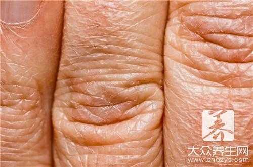 孕期乳头皴裂(产妇乳头皲裂怎么办) 第2张 孕期乳头皴裂(产妇乳头皲裂怎么办) 第2张