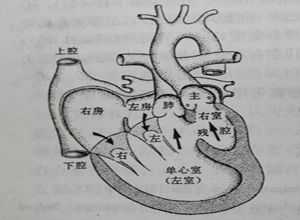 单心房单心室什么意思,胎儿单心室还能生存吗 第1张 单心房单心室什么意思,胎儿单心室还能生存吗 第1张