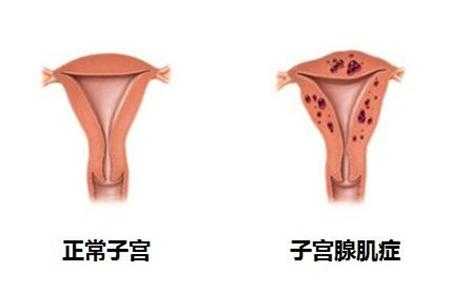 子宫充血是什么回事?需要怎样治疗,孕期子宫充血怎么办 第2张 子宫充血是什么回事?需要怎样治疗,孕期子宫充血怎么办 第2张