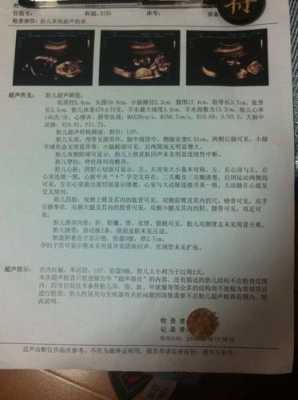 四维彩超上面写的见切面是什么意思啊,胎儿肢体切面仅局部可见 第1张 四维彩超上面写的见切面是什么意思啊,胎儿肢体切面仅局部可见 第1张