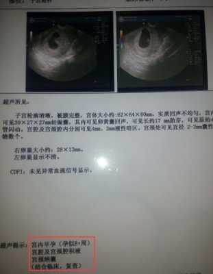 胎儿很少动正常吗（怀孕39周了宝宝不爱动是怎么回事？是缺氧）  第1张