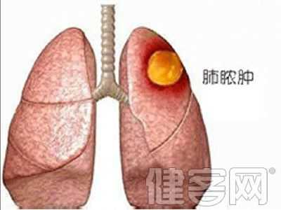 宝宝气管炎,怀孕支气管病毒胎儿会怎么样  第2张