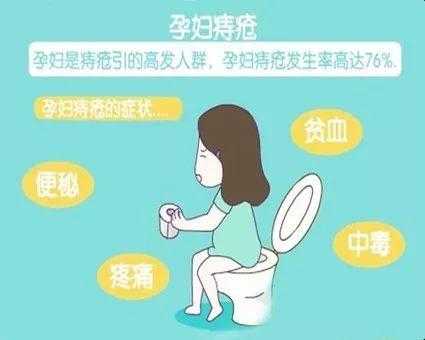孕期长了痔疮(孕妇长痔疮怎么办,怎么治疗最好) 第3张 孕期长了痔疮(孕妇长痔疮怎么办,怎么治疗最好) 第3张
