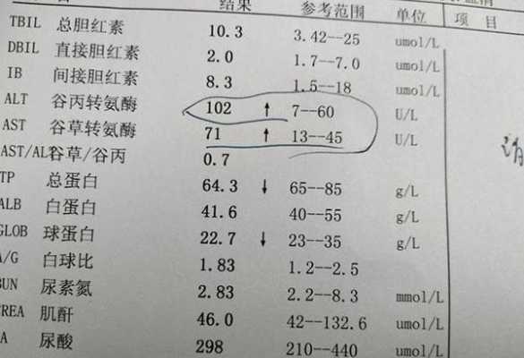 孕期转氨酶低(孕期转氨酶高能不能吃燕窝) 第2张 孕期转氨酶低(孕期转氨酶高能不能吃燕窝) 第2张