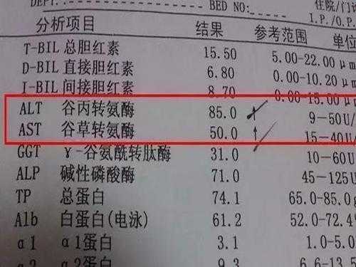 孕期转氨酶低(孕期转氨酶高能不能吃燕窝) 第1张 孕期转氨酶低(孕期转氨酶高能不能吃燕窝) 第1张