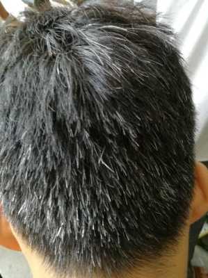 怀孕奶头变黑怎么回事?正常嘛,孕期头发变黑怎么回事 第2张 怀孕奶头变黑怎么回事?正常嘛,孕期头发变黑怎么回事 第2张