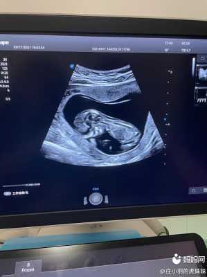 胎儿趴着就是女孩吗(趴着进幼儿园啥意思) 第2张 胎儿趴着就是女孩吗(趴着进幼儿园啥意思) 第2张