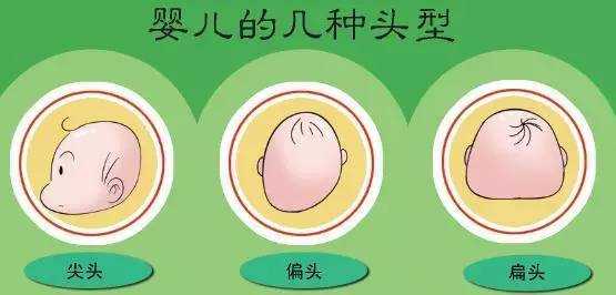 小头畸形的诊断标准是什么,如何排查胎儿小头畸形的原因 第3张 小头畸形的诊断标准是什么,如何排查胎儿小头畸形的原因 第3张