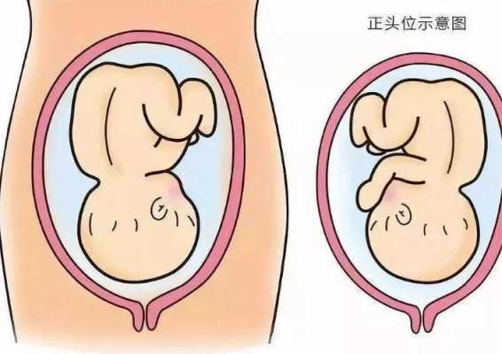 胎儿rot是什么胎位(胎儿ROT是什么胎位) 第1张 胎儿rot是什么胎位(胎儿ROT是什么胎位) 第1张