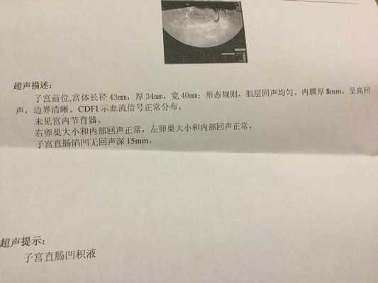 子宫有积液是怎么回事呢,孕期子宫积液要紧吗 第2张 子宫有积液是怎么回事呢,孕期子宫积液要紧吗 第2张