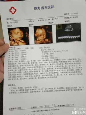 怎么知道宝宝面向你还是背对你,怎么看胎儿脸朝里脸朝外 第1张 怎么知道宝宝面向你还是背对你,怎么看胎儿脸朝里脸朝外 第1张