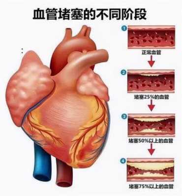 胎儿心脏血管异常原因(心脏多一根血管,要怎么办) 第2张 胎儿心脏血管异常原因(心脏多一根血管,要怎么办) 第2张