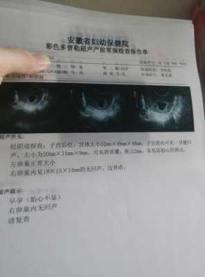 怀孕67天胎儿高清图(67天的宝宝60cm矮吗) 第3张 怀孕67天胎儿高清图(67天的宝宝60cm矮吗) 第3张