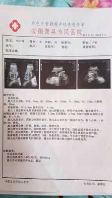 建议胎儿超声心动检查(建议胎儿超声心动检查) 第2张 建议胎儿超声心动检查(建议胎儿超声心动检查) 第2张