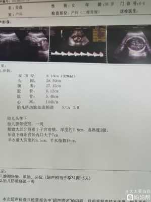 怀孕31周总是胸口闷喘不过气来是怎么回事,胎儿顶在胸口怎么回事 第2张 怀孕31周总是胸口闷喘不过气来是怎么回事,胎儿顶在胸口怎么回事 第2张