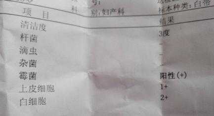 孕初期大便的时候有灰色白带,孕期灰白色分泌物 第2张 孕初期大便的时候有灰色白带,孕期灰白色分泌物 第2张
