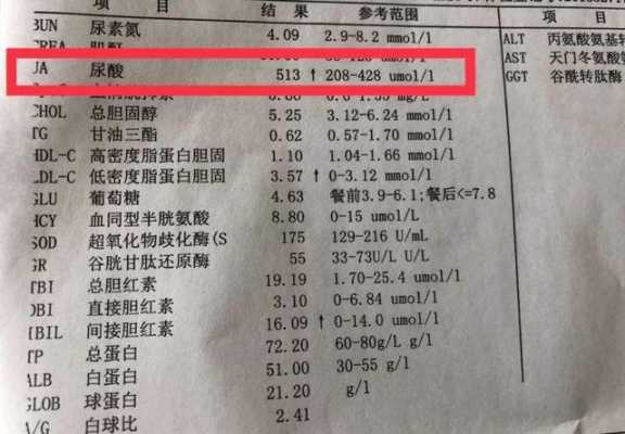 孕期尿酸高(孕期尿酸高) 第1张 孕期尿酸高(孕期尿酸高) 第1张
