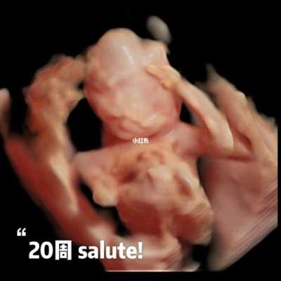 二十周胎儿有多大,怀孕20周胎儿真实图片欣赏 第2张 二十周胎儿有多大,怀孕20周胎儿真实图片欣赏 第2张