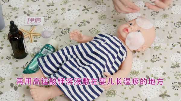 孕妇湿疹用什么药膏效果最好,孕期急性湿疹怎么治疗 第2张 孕妇湿疹用什么药膏效果最好,孕期急性湿疹怎么治疗 第2张