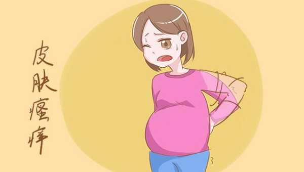 孕期身体瘙痒(孕期身体瘙痒是什么原因) 第1张 孕期身体瘙痒(孕期身体瘙痒是什么原因) 第1张