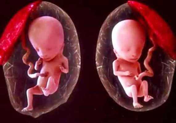 孕妇29周胎儿是多少重?怎样计算怀孕29周的胎儿有多重呢,怀孕29周胎儿图片真人 第3张 孕妇29周胎儿是多少重?怎样计算怀孕29周的胎儿有多重呢,怀孕29周胎儿图片真人 第3张