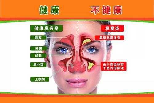 鼻炎引起咳嗽如何治疗怎么回事,孕期鼻炎咳嗽对胎儿有影响吗 第1张 鼻炎引起咳嗽如何治疗怎么回事,孕期鼻炎咳嗽对胎儿有影响吗 第1张