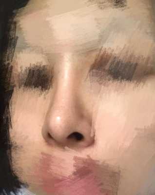 彭体隆鼻+耳软骨鼻尖一个月鼻头很硬正常么,孕期鼻子变硬怎么回事 第2张 彭体隆鼻+耳软骨鼻尖一个月鼻头很硬正常么,孕期鼻子变硬怎么回事 第2张
