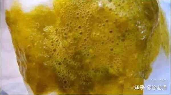 宝宝便便沾衣服上了,如何清洗才干净,胎儿的粪便去哪了图片 第1张 宝宝便便沾衣服上了,如何清洗才干净,胎儿的粪便去哪了图片 第1张