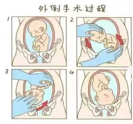 35周臀位胎儿图（35周臀位胎儿图片真实）  第3张