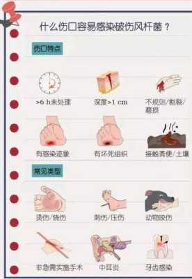 怀孕了可以打破伤风吗,破伤风针对胎儿的影响大吗  第2张