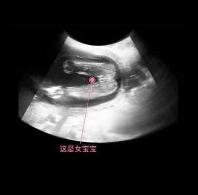 怀孕17周胎儿彩超图(孕17周胎儿在什么位置) 第2张 怀孕17周胎儿彩超图(孕17周胎儿在什么位置) 第2张
