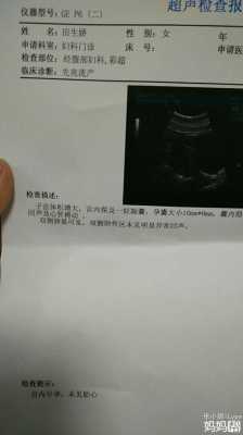 如何防止胎儿没有胎心（如何防止胎儿没有胎心胎芽）  第2张