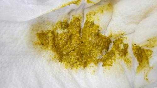 大便特别黏是怎么回事,孕期大便很黏很难解下来怎么办?  第1张