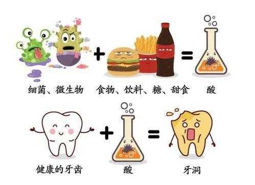 孕期蛀牙疼痛(孕期蛀牙疼痛难忍怎么缓解) 第2张 孕期蛀牙疼痛(孕期蛀牙疼痛难忍怎么缓解) 第2张