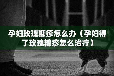 孕期玫瑰糠疹(玫瑰糠疹的治疗方法有哪些) 第2张 孕期玫瑰糠疹(玫瑰糠疹的治疗方法有哪些) 第2张
