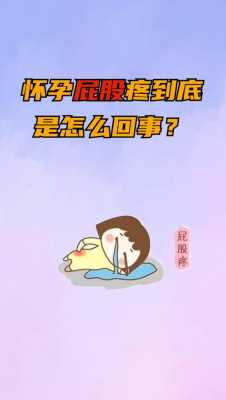 孕期走路屁股疼(孕期走路屁股疼是怎么回事) 第2张 孕期走路屁股疼(孕期走路屁股疼是怎么回事) 第2张