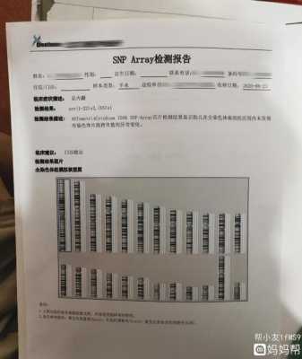 胎儿基因芯片报告图(羊水穿刺要加基因芯片吗) 第1张 胎儿基因芯片报告图(羊水穿刺要加基因芯片吗) 第1张