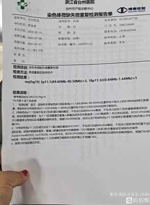 胎儿基因芯片报告图(羊水穿刺要加基因芯片吗) 第2张 胎儿基因芯片报告图(羊水穿刺要加基因芯片吗) 第2张