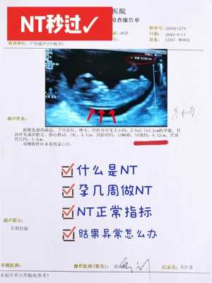 孕期nt检查时间(一般怀孕多久要做nt检查呢?需要多久时间) 第2张 孕期nt检查时间(一般怀孕多久要做nt检查呢?需要多久时间) 第2张