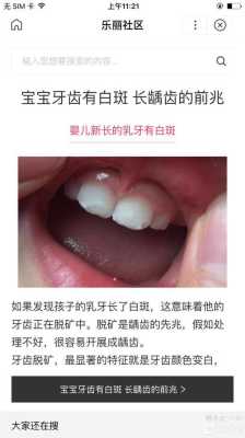 孕妇吃什么胎儿会白(宝宝牙齿有白斑怎么回事?白斑是什么原因引起的呢) 第1张 孕妇吃什么胎儿会白(宝宝牙齿有白斑怎么回事?白斑是什么原因引起的呢) 第1张