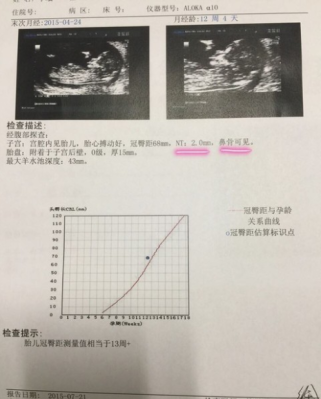 产检中说的nt到底是什么意思,孕期NT是什么检查 第3张 产检中说的nt到底是什么意思,孕期NT是什么检查 第3张
