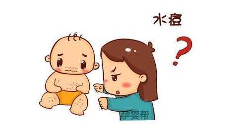 孕妇得水痘胎儿能要吗(孕妇得水痘对胎儿影响) 第2张 孕妇得水痘胎儿能要吗(孕妇得水痘对胎儿影响) 第2张