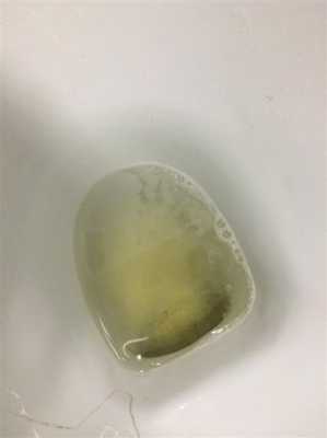 孕期尿有泡沫(孕期尿有泡沫是什么问题) 第1张 孕期尿有泡沫(孕期尿有泡沫是什么问题) 第1张