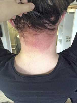 染发对孕妇影响大吗,经常染头发的话,会导致胎儿出现畸形的吗,孕期可以染发吗孕妇专用 第1张 染发对孕妇影响大吗,经常染头发的话,会导致胎儿出现畸形的吗,孕期可以染发吗孕妇专用 第1张