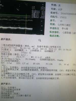 请问心脏彩超能查出心衰吗?心衰会有什么样的症状啊?谁知道吗,胎儿心脏增大有危险吗 第1张 请问心脏彩超能查出心衰吗?心衰会有什么样的症状啊?谁知道吗,胎儿心脏增大有危险吗 第1张