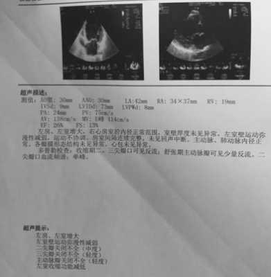 请问心脏彩超能查出心衰吗?心衰会有什么样的症状啊?谁知道吗,胎儿心脏增大有危险吗 第2张 请问心脏彩超能查出心衰吗?心衰会有什么样的症状啊?谁知道吗,胎儿心脏增大有危险吗 第2张