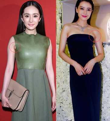 副乳严重是内衣大了还是小了,孕期副乳乳头会消失吗 第1张 副乳严重是内衣大了还是小了,孕期副乳乳头会消失吗 第1张