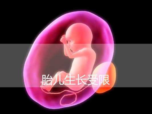 生长受限胎儿小5周(胎儿宫内生长受限是什么?需要注意什么) 第1张 生长受限胎儿小5周(胎儿宫内生长受限是什么?需要注意什么) 第1张