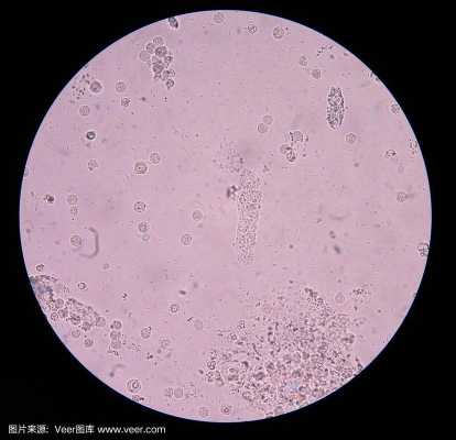 孕期尿有细菌(孕期尿有细菌是怎么回事) 第2张 孕期尿有细菌(孕期尿有细菌是怎么回事) 第2张