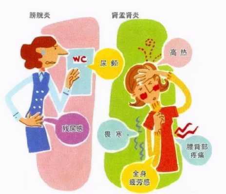 孕期尿有细菌(孕期尿有细菌是怎么回事) 第1张 孕期尿有细菌(孕期尿有细菌是怎么回事) 第1张